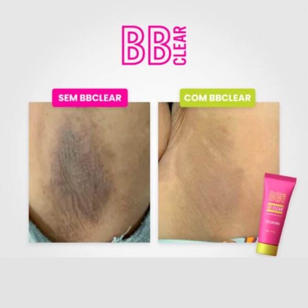 BB Clear Clareador Facial e Corporal | Uniformiza Tom, Hidrata e Reduz Manchas Escuras Rápido - Imagem 3